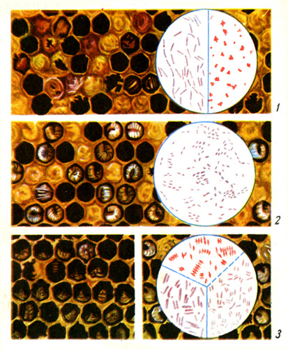 Таблица 6. Инфекционные болезни пчелиного расплода: 1 — расплод, пораженный американским гнильцом (в круге возбудитель болезни бацилла ларве — палочки и споры под микроскопом); 2 — расплод, пораженный европейским гнильцом (в круге возбудитель болезни бактерия плютон под микроскопом); 3 — в круге микробы-спутники, встречающиеся при европейском гнильце; 4 — личинки, погибшие от мешотчатого расплода 